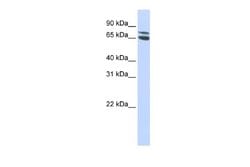 ZBTB48 Antibody, Novus Biologicals 100 &mu;L; Unconjugated:Antibodies,